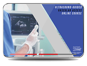 Ultrasound Guided Vascular Access: A Comprehensive Guide